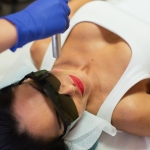 Cynosure Apogee Elite