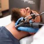 Cynosure Apogee Elite