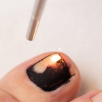 Cynosure Apogee Elite