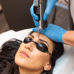 Cynosure Apogee Elite